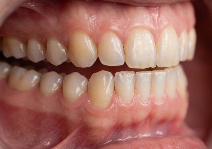presion_mandibula